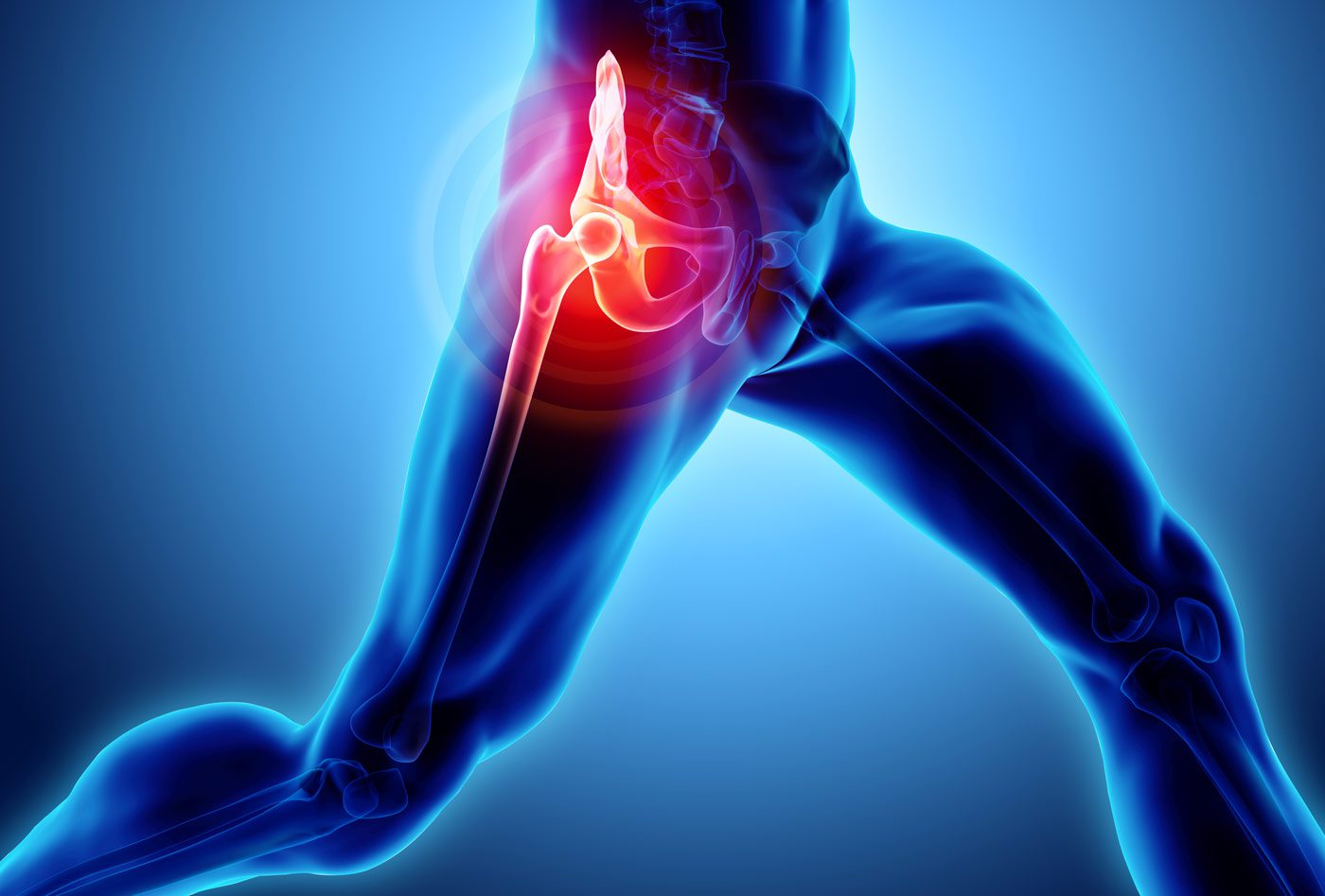 Our approach to treating hip pain